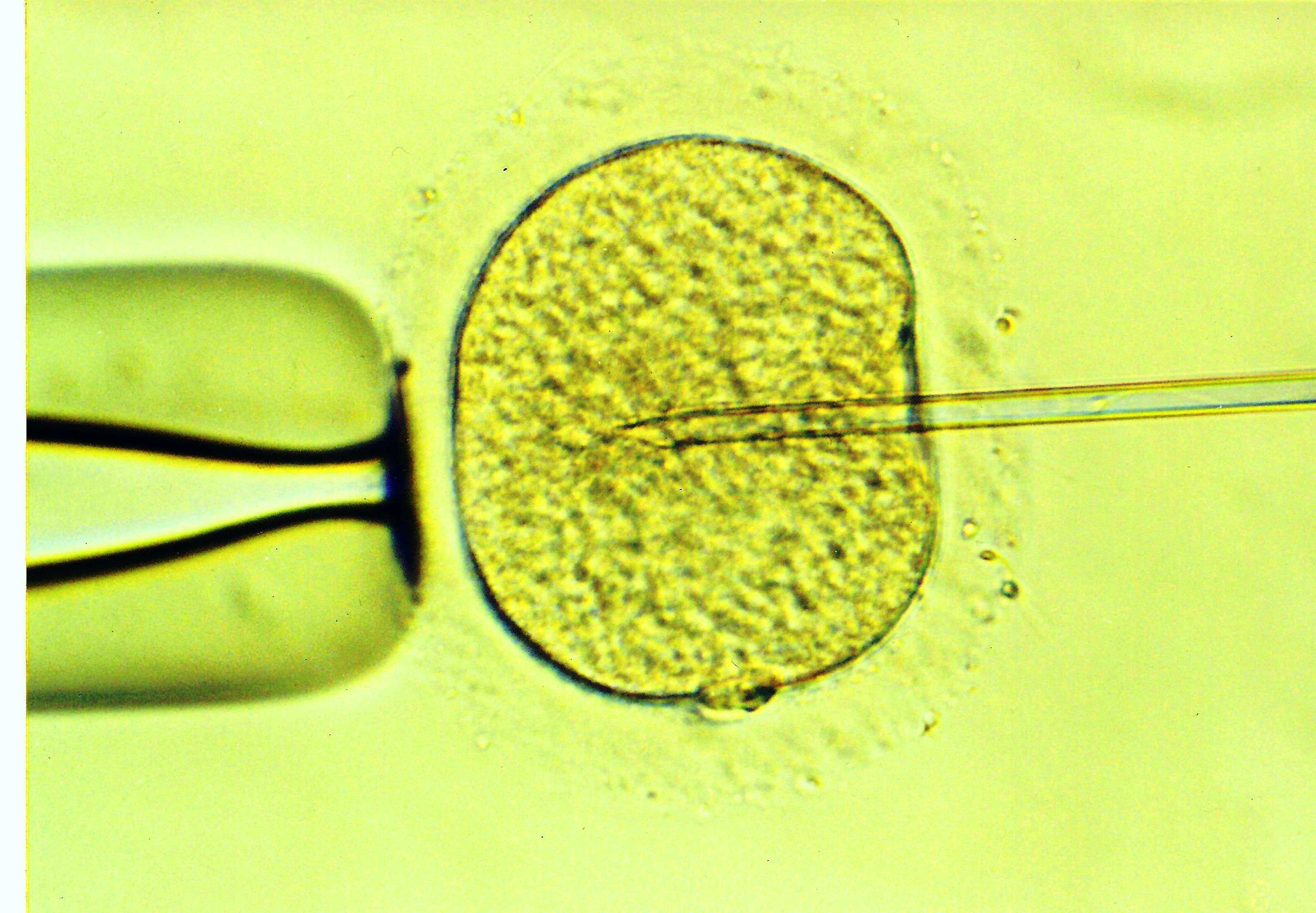 proimages/单一精虫卵细胞质注射.jpg
