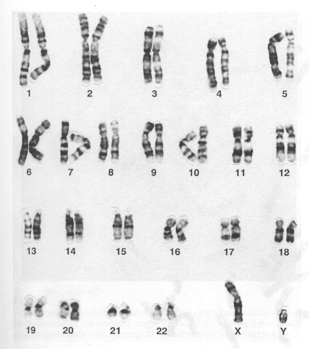 人类染色体_人类染色体数目_微信公众号文章